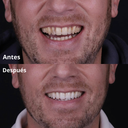 Cepillo Ancestral Miswak