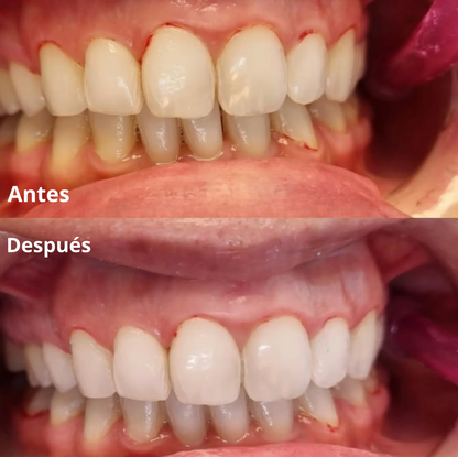 Cepillo Ancestral Miswak